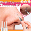 Load image into Gallery viewer, Professional Facial Blackhead Removing Tweezer Kit